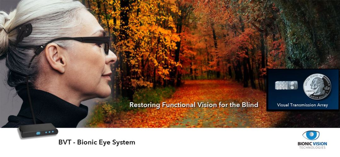 BVT Bionic Eye System. Restoring Functional Vision for the Blind