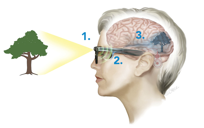 Bionic_Eye