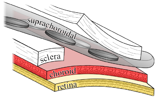Novel_Surgical